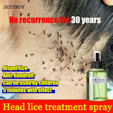kuto ng manok sa tao|Best Head Lice Treatment Method .
